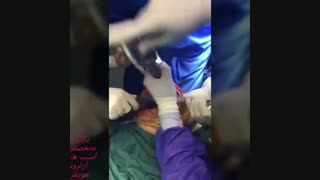 مراحل تعویض مفصل زانو