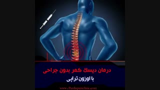 درمان دیسک کمر بدون جراحی با اوزون درمانی
