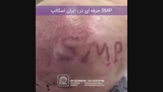 smp IRANSCALP