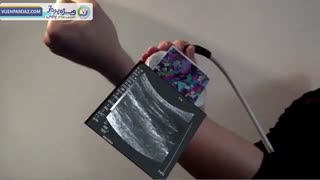 کاربرد واقعیت افزوده در سونوگرافی
