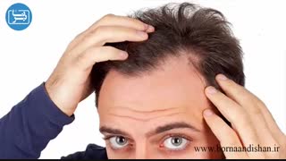 اختلال وسواس موکنی چیست و چه ویژگی هایی دارد؟