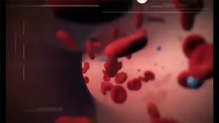درمان گرفتگی عروق با زالو درمانی