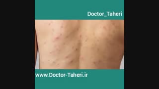 نشانه های کبد سمی | دکتر امیر طاهری