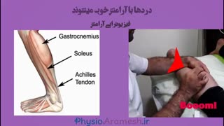 فیزیوتراپی بدنسازان با درای نیدلینگ