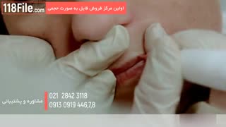 ترفند تتو صورت برای داشتن لب های قرینه و خوشگل