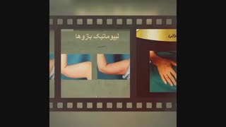 لیپوماتیک - دکتر ابدالی - 22807060