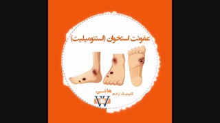 عفونت استخوان