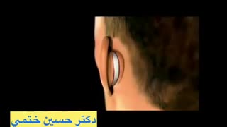 فیلم جراحی زیبایی گوش
