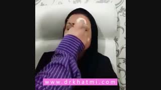 نحوه چسب زدن بینی توسط دکتر حسین ختمی