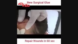 بستن زخم با چسب مایع