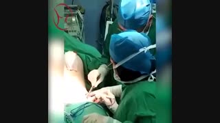 سه جراحی لیفت و پروت سینه و ابدومینوپلاستی به طور همزمان !