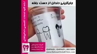 جایگزینی دندان از دست رفته | کلینیک دندانپزشکی بیمارستان بهمن