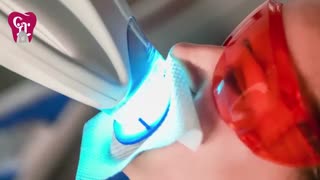 بیلیچینگ در مطب