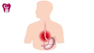 عوارض بوی بد دهان | کلینیک دندانپزشکی بیمارستان بهمن