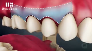 عوارض عدم رعایت بهداشت دهان و دندان | دکتر لیلا عطایی