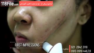آموزش پاکسازی صورت-0تا100