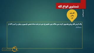 برطرف کردن لکه ازفرش