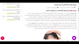 ریزش موی ارثی از چه سنی شروع میشود