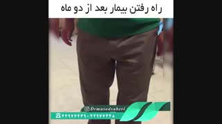 نتیجه تعویض مفصل زانو بعد از دو ماه | دکتر مسعود صابری متخصص ارتوپد پروتز سینه