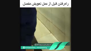 نتیجه عمل تعویض مفصل مصنوعی | دکتر مسعود صابری متخصص ارتوپد میکرونیدلینگ