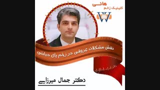 تاثیر مشکلات عروقی در درمان زخم دیابتی