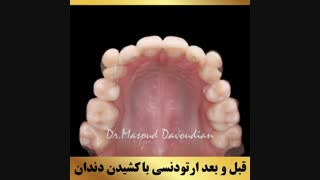 دکتر ارتودنسی در تهران | دکتر داودیان