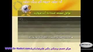 مروری کلی بر آب مروارید - مرکز چشم پزشکی دکتر علیرضا نادری