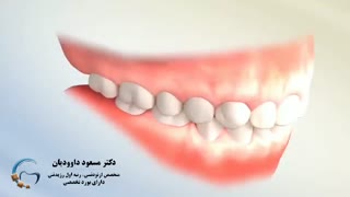 ارتودنسی تهران | دکتر داوودیان