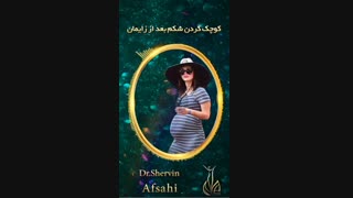 کوچک کردن شکم بعد از زایمان