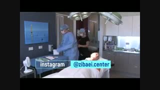 جراحی زیبایی گوش یا عمل اتوپلاستی - سایت زیبایی سنتر