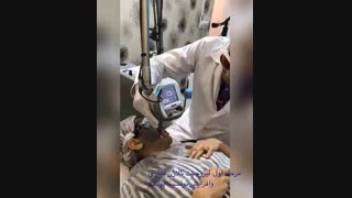 لیزر جهت کلاژن سازی پوست جراحی زیبایی پلک