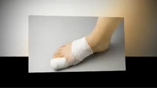 زخم پای دیابتی