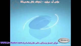 لنز داخل چشمی - مرکز چشم پزشکی دکتر علیرضا نادری
