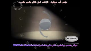 انتخاب لنز داخل چشمی مناسب - مرکز چشم پزشکی دکتر علیرضا نادری