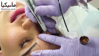 میکروبلیدینگ فیبروز حرفه ای - 09120660447