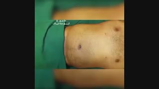 لیپوماتیک - دکتر ابدالی - 22807060