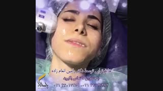 فیلم هایفوتراپی صورت
