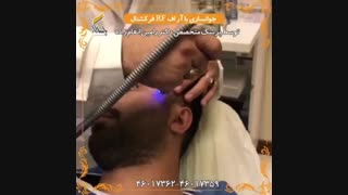 جوانسازی صورت با آر اف فرکشنال