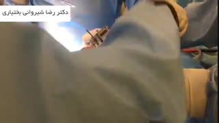 مراحل تعویض مفصل زانو
