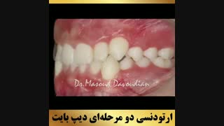 ارتودنتیست تهران | دکتر داودیان