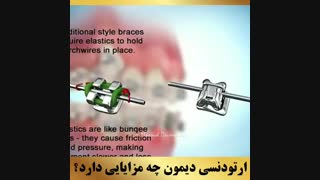 بهترین دکتر ارتودونسی تهران | دکتر داوودیان