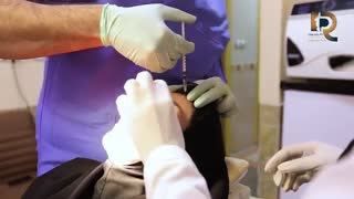 مراقبت بعد از تزریق بوتاکس اصلاح طرح لبخند