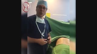 لیفت شکم و باسن به طور همزمان
