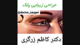 انیمیشن جراحی پلک
