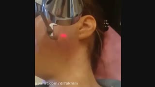 از بین بردن بردن منافذ پوست