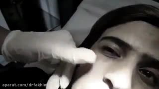 تزریق ژل زیر چشم