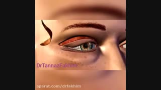 جراحی زیبایی پلک