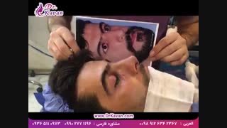 عمل انحراف بینی توسط دکتر کاوان