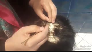 ترمیم موی الگانت /تعمیرات پروتز مو /02188962259