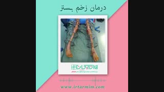 درمان زخم بستر